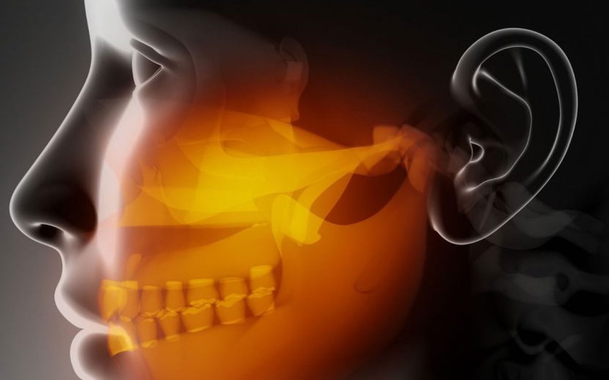 O bruxismo não é só “ranger ou apertar os dentes”